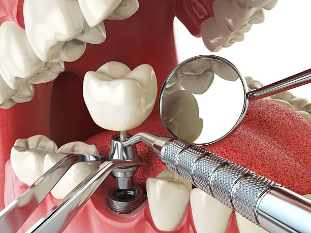 Best Emergency Gum Treatment in Greendale, WI